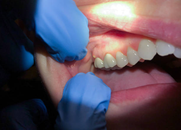 Best Cracked Tooth Emergency Dentist  in Smyrna, DE